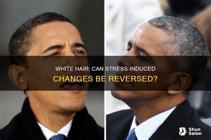 Can white hair due to stress be reversed?