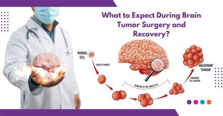 How long can you live after brain tumor surgery?